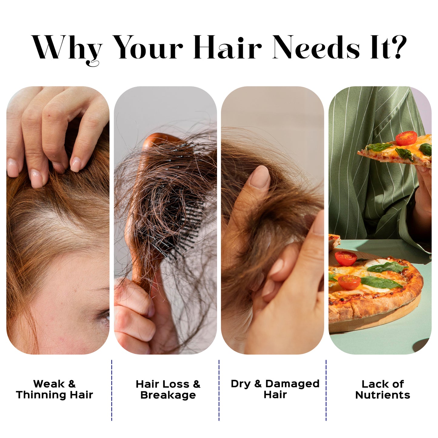 GSSB Biotin Gummies for Hair Growth, Skin & Nails – Strawberry Flavour – With Multivitamin, Zinc & DHT Blocker – 30 Gummies – Stronger Hair, Glowing Skin, Healthy Nails – For Men & Women (Pack of 1)